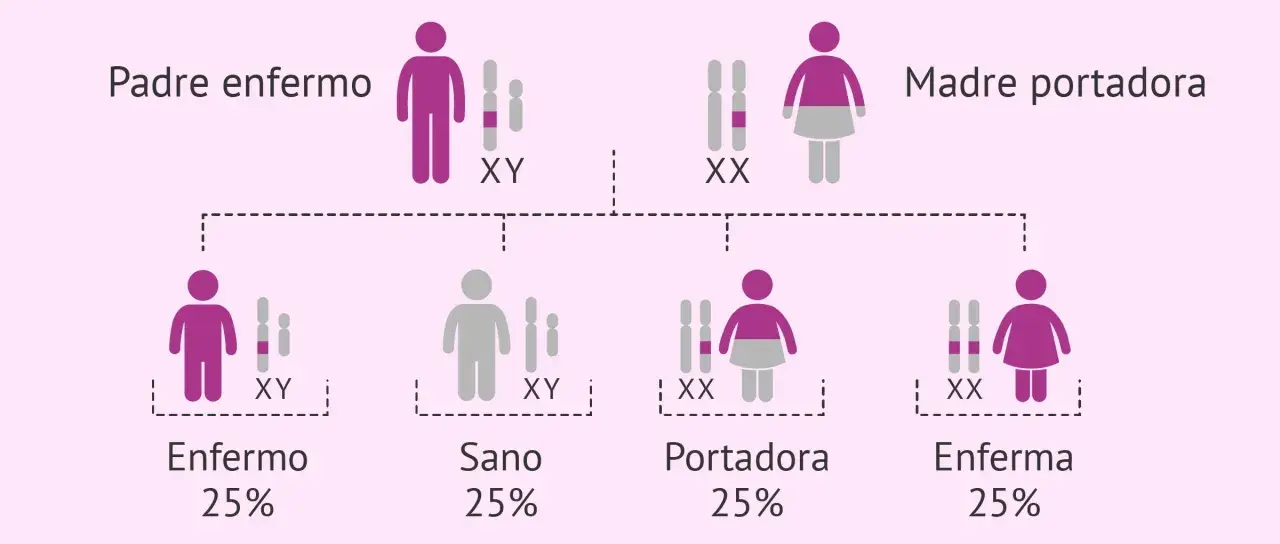 Diagrama muestra cómo las enfermedades se heredan del padre o de la madre. Padre enfermo (XY) y madre portadora (XX) tienen hijos sanos, enfermos o portadores.