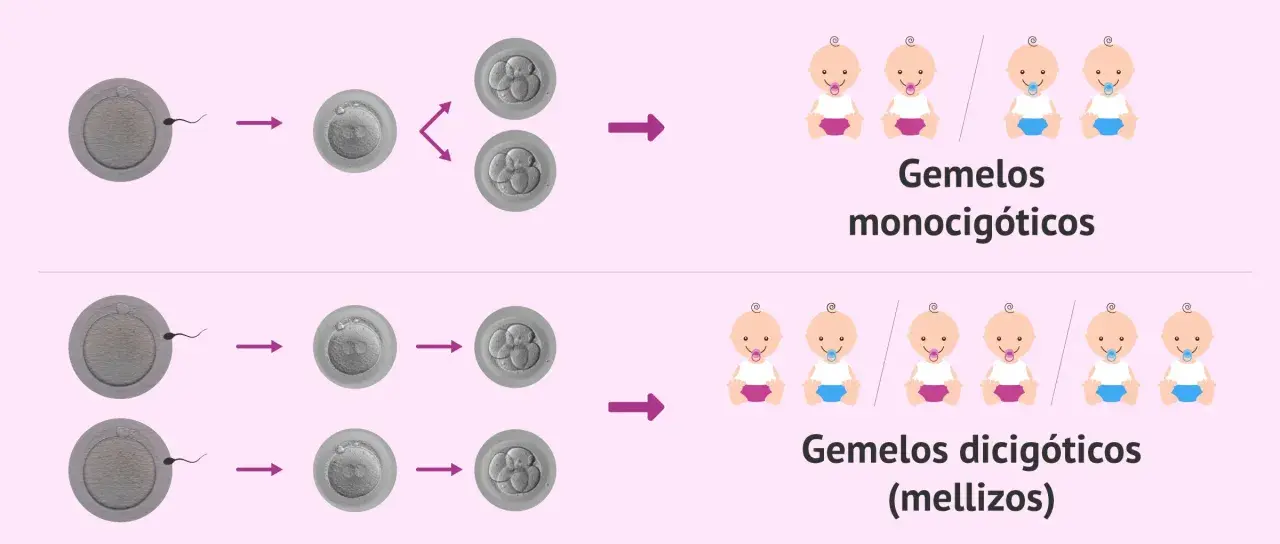 Ilustración de la concepción de gemelos. Los gemelos monocigóticos provienen de un óvulo y un espermatozoide, y pueden ser niño y niña. Los dicigóticos, de dos óvulos y dos espermatozoides.
