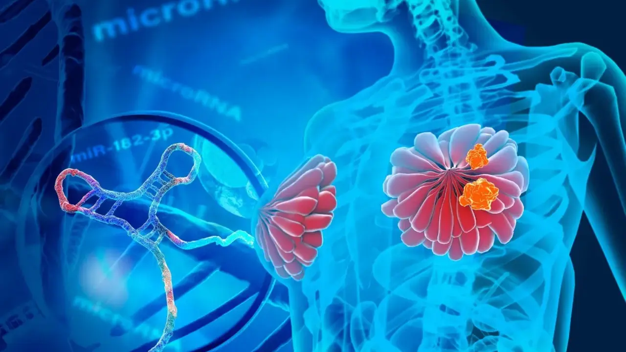 Representación visual de un estudio genético del cáncer de mama, con microARN y ADN.