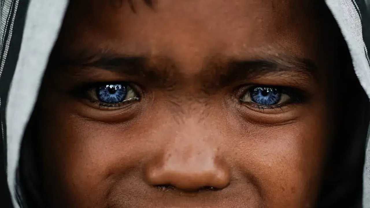 Ojos azules intensos, como el cielo, en un rostro joven. Podrían ser un rasgo distintivo del síndrome de Waardenburg, que a menudo se manifiesta con ojos de colores inusuales.