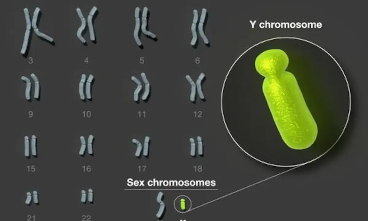 Cariotipo humano con cromosomas sexuales X e Y resaltados. El cromosoma Y, de color verde brillante, se muestra ampliado.