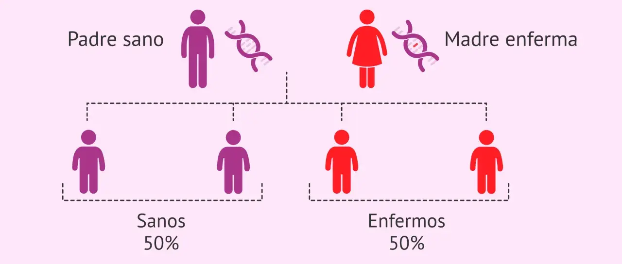 Diagrama de herencia: padre sano y madre enferma, con 50% de hijos sanos y 50% enfermos, ilustrando las causas de la enfermedad de Huntington.