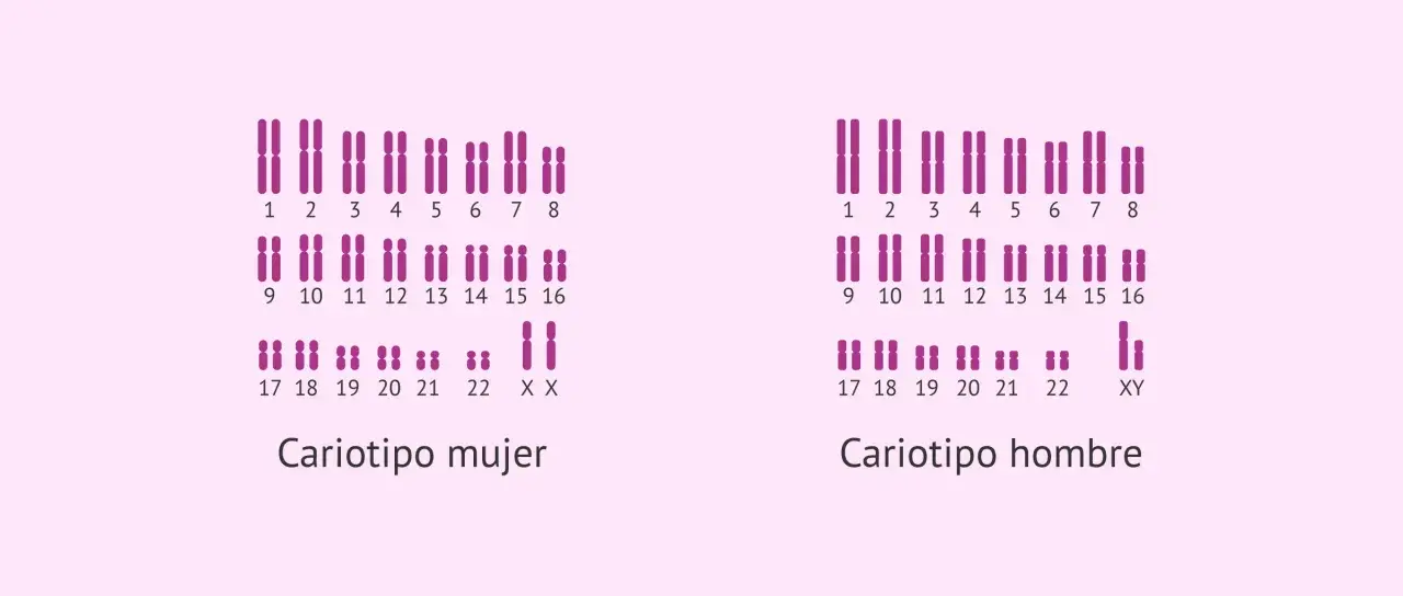 Cariotipo mujer y hombre. Un cariotipo que enfermedades detecta, como anomalías cromosómicas, se muestra con pares de cromosomas.