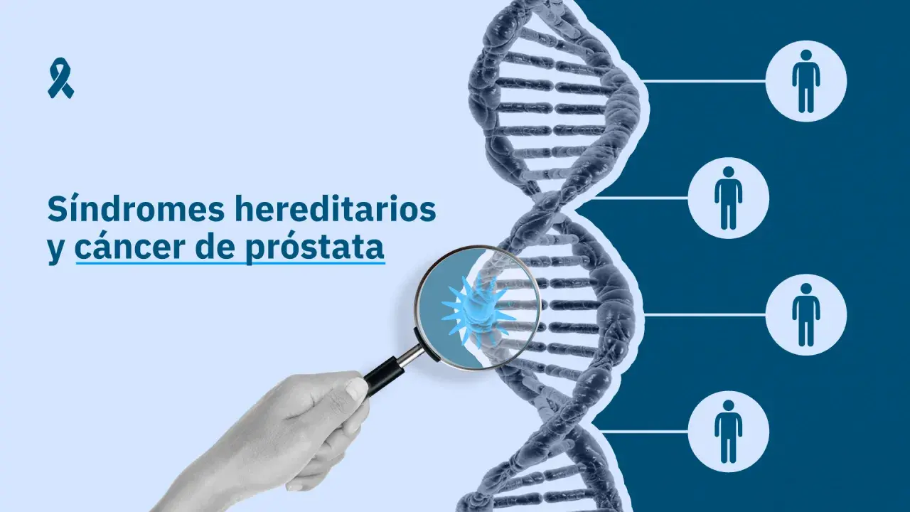 La imagen muestra una cadena de ADN y el texto "Síndromes hereditarios y cáncer de próstata". Un microscopio revela una célula cancerosa, sugiriendo que el cáncer de próstata es hereditario.