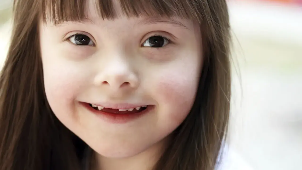 Niña sonriente con síndrome de Down, una condición que no define su luz.