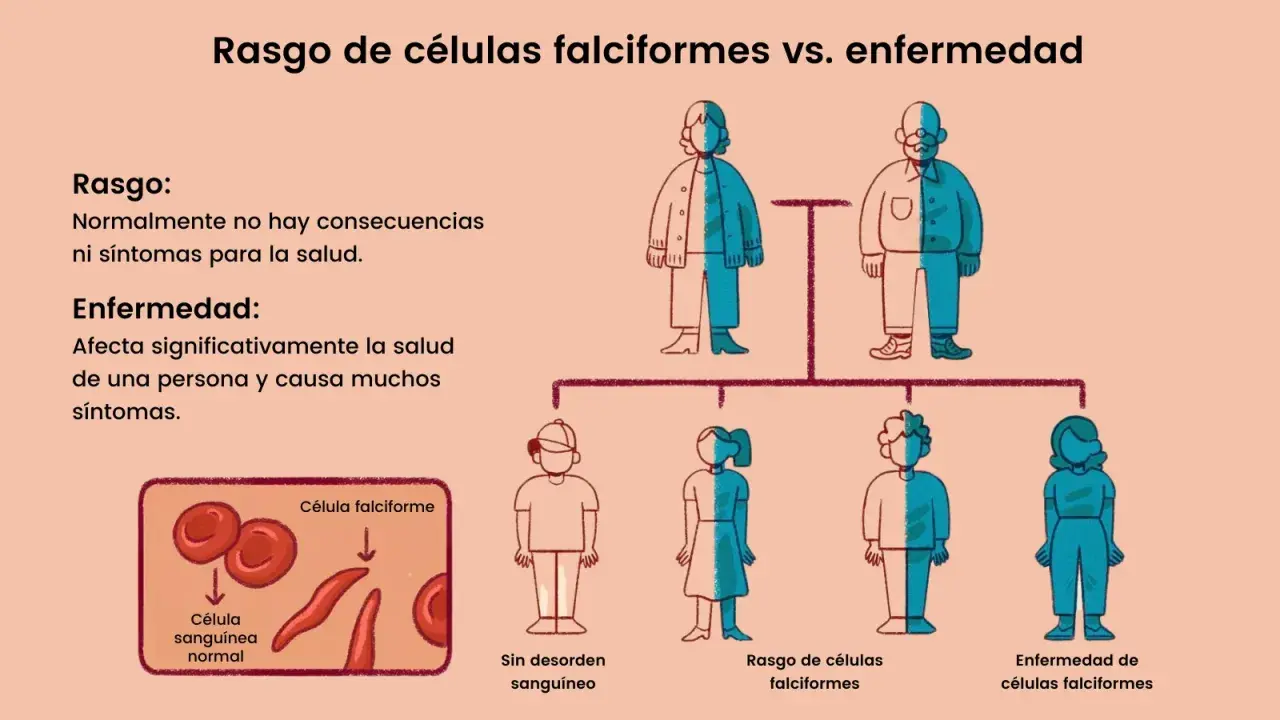 Ilustración compara rasgo de células falciformes (sin síntomas) con la enfermedad, causada por la mutación de anemia falciforme. Muestra células normales y falciformes.