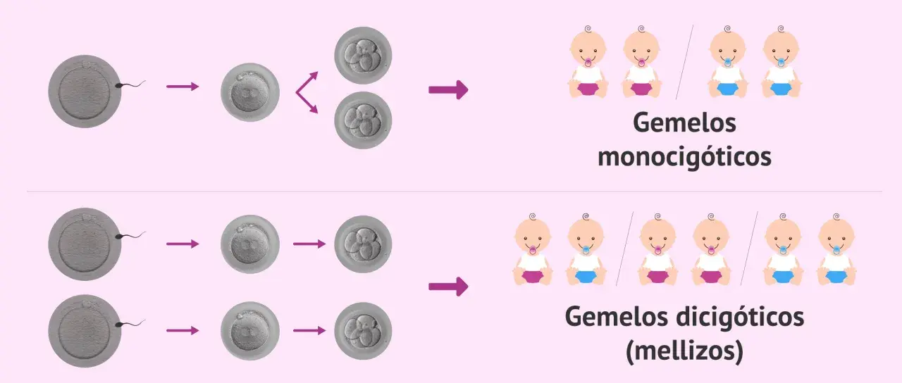 Ilustración muestra cómo un espermatozoide fecunda un óvulo, dando lugar a gemelos monocigóticos o dicigóticos. Tener gemelos depende del hombre o de la mujer.