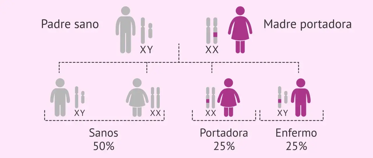 Diagrama de herencia genética. Padre sano (XY) y madre portadora (XX) tienen hijos sanos (50%), portadores (25%) y enfermos (25%), mostrando la transmisión de cromosomas x.