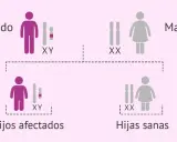Padre afectado (XY) y madre sana (XX) tienen hijos afectados (XY) y hijas sanas (XX). El cromosoma Y determina el sexo masculino.