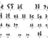 Cariotipo humano con 23 pares de cromosomas, incluyendo los autosomas del 1 al 22 y los cromosomas sexuales X e Y. Un análisis qf pcr revela la estructura de cada par.