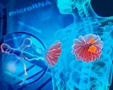 Representación visual de un estudio genético del cáncer de mama, con microARN y ADN.