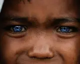 Ojos azules intensos, como el cielo, en un rostro joven. Podrían ser un rasgo distintivo del síndrome de Waardenburg, que a menudo se manifiesta con ojos de colores inusuales.
