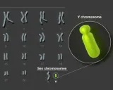 Cariotipo humano con cromosomas sexuales X e Y resaltados. El cromosoma Y, de color verde brillante, se muestra ampliado.