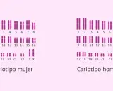 Cariotipo mujer y hombre. Un cariotipo que enfermedades detecta, como anomalías cromosómicas, se muestra con pares de cromosomas.