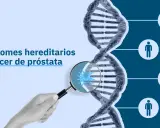 La imagen muestra una cadena de ADN y el texto "Síndromes hereditarios y cáncer de próstata". Un microscopio revela una célula cancerosa, sugiriendo que el cáncer de próstata es hereditario.