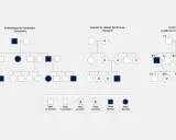 Pedigríes que muestran herencia de Huntington, anemia falciforme y hemofilia, ilustrando hasta que generación se heredan los genes.
