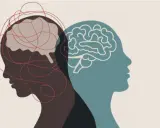 Dos perfiles de cabeza, uno con un cerebro enredado y otro con un cerebro claro, simbolizan la complejidad de una enfermedad multifactorial.