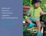 Niño con síndrome de Down bebe jugo. El texto habla de defectos del nacimiento, malformaciones congénitas y enfermedades genéticas, indicando que es congénito y hereditario.