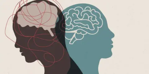 Dos perfiles de cabeza, uno con un cerebro enredado y otro con un cerebro claro, simbolizan la complejidad de una enfermedad multifactorial.