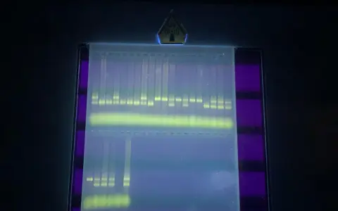 Banda de ADN fluorescente en gel de agarosa, clave para la interpretación de electroforesis.