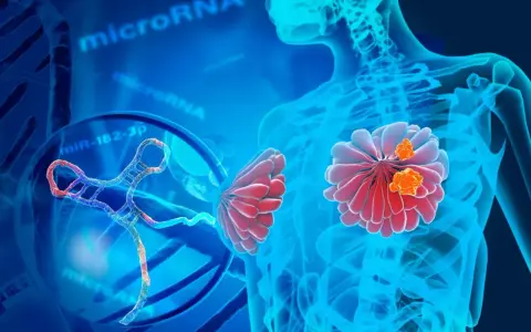 Representación visual de un estudio genético del cáncer de mama, con microARN y ADN.