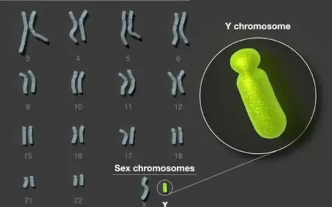 Cariotipo humano con cromosomas sexuales X e Y resaltados. El cromosoma Y, de color verde brillante, se muestra ampliado.