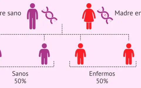 Diagrama de herencia: padre sano y madre enferma, con 50% de hijos sanos y 50% enfermos, ilustrando las causas de la enfermedad de Huntington.