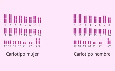 Cariotipo mujer y hombre. Un cariotipo que enfermedades detecta, como anomalías cromosómicas, se muestra con pares de cromosomas.