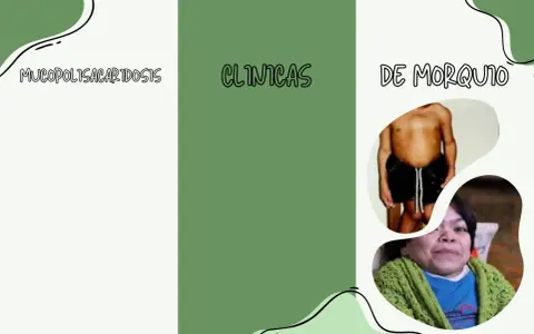 Mucopolisacaridosis: clínicas de Morquio. Imágenes de personas con esta condición.