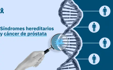 La imagen muestra una cadena de ADN y el texto "Síndromes hereditarios y cáncer de próstata". Un microscopio revela una célula cancerosa, sugiriendo que el cáncer de próstata es hereditario.