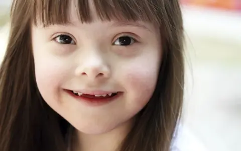 Niña sonriente con síndrome de Down, una condición que no define su luz.