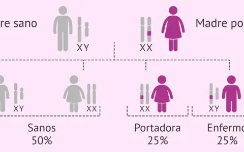 Diagrama de herencia genética. Padre sano (XY) y madre portadora (XX) tienen hijos sanos (50%), portadores (25%) y enfermos (25%), mostrando la transmisión de cromosomas x.