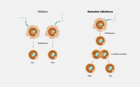 Ilustración de la fertilización de óvulos por espermatozoides, mostrando mellizos y gemelos idénticos.
