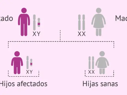 Padre afectado (XY) y madre sana (XX) tienen hijos afectados (XY) y hijas sanas (XX). El cromosoma Y determina el sexo masculino.