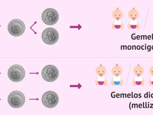 Ilustración de la concepción de gemelos. Los gemelos monocigóticos provienen de un óvulo y un espermatozoide, y pueden ser niño y niña. Los dicigóticos, de dos óvulos y dos espermatozoides.