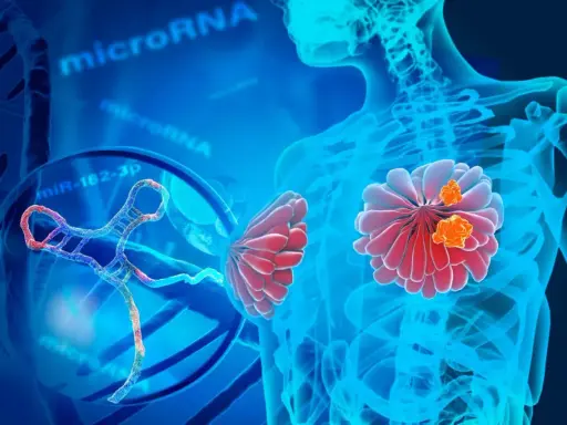 Representación visual de un estudio genético del cáncer de mama, con microARN y ADN.