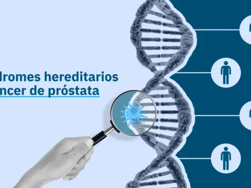 La imagen muestra una cadena de ADN y el texto "Síndromes hereditarios y cáncer de próstata". Un microscopio revela una célula cancerosa, sugiriendo que el cáncer de próstata es hereditario.