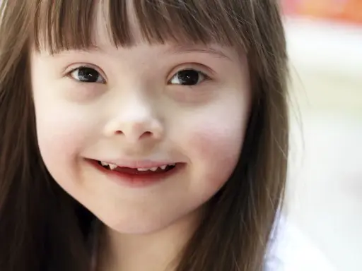 Niña sonriente con síndrome de Down, una condición que no define su luz.