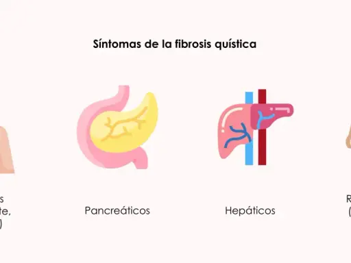 Ilustración de síntomas de fibrosis quística: respiratorios (tos, mucosidad), pancreáticos, hepáticos y reproductivos (azoospermia obstructiva).