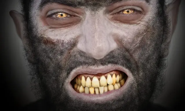 Rostro de hombre con ojos amarillos y colmillos afilados, cubierto de pelo oscuro. Parece sufrir la enfermedad del hombre lobo.