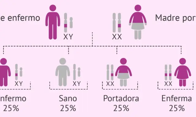 Diagrama muestra cómo las enfermedades se heredan del padre o de la madre. Padre enfermo (XY) y madre portadora (XX) tienen hijos sanos, enfermos o portadores.