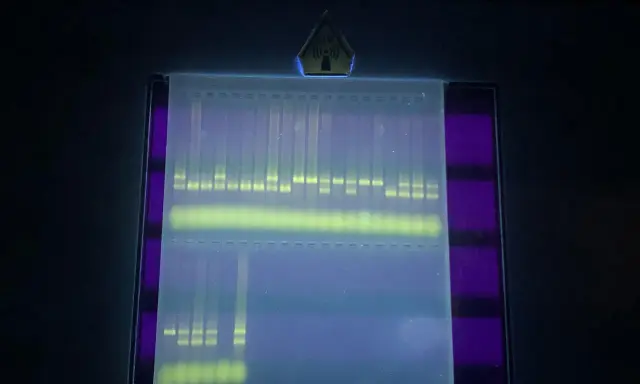 Banda de ADN fluorescente en gel de agarosa, clave para la interpretación de electroforesis.