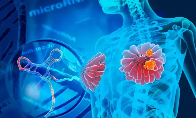 Representación visual de un estudio genético del cáncer de mama, con microARN y ADN.