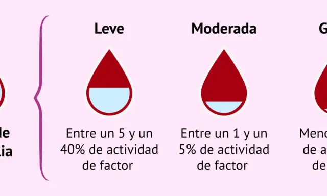 Ilustración de tipos de hemofilia: leve (5-40% actividad factor), moderada (1-5%) y grave (<1%).