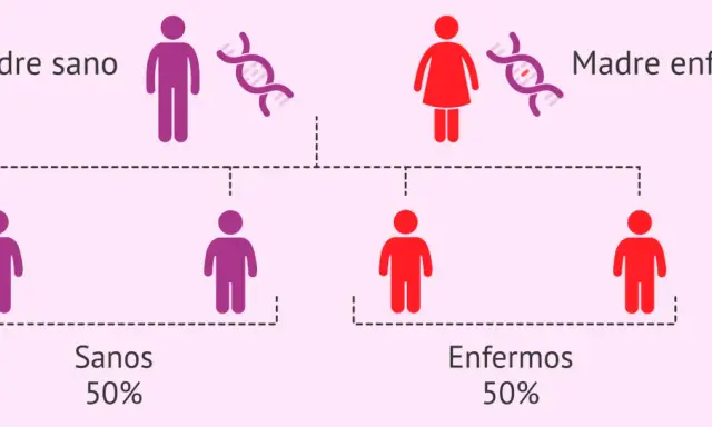 Diagrama de herencia: padre sano y madre enferma, con 50% de hijos sanos y 50% enfermos, ilustrando las causas de la enfermedad de Huntington.