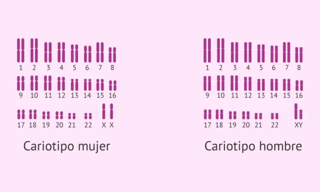 Cariotipo mujer y hombre. Un cariotipo que enfermedades detecta, como anomalías cromosómicas, se muestra con pares de cromosomas.