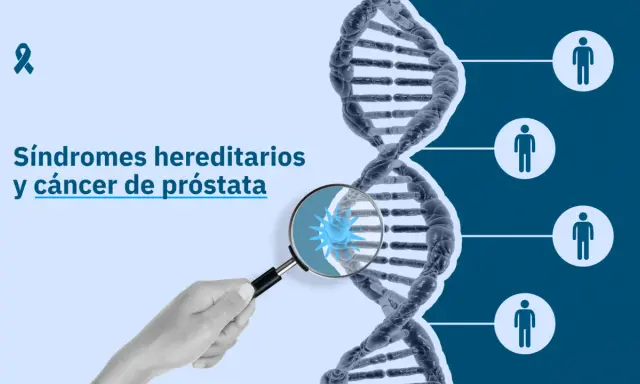 La imagen muestra una cadena de ADN y el texto "Síndromes hereditarios y cáncer de próstata". Un microscopio revela una célula cancerosa, sugiriendo que el cáncer de próstata es hereditario.