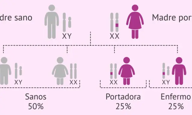 Diagrama de herencia genética. Padre sano (XY) y madre portadora (XX) tienen hijos sanos (50%), portadores (25%) y enfermos (25%), mostrando la transmisión de cromosomas x.