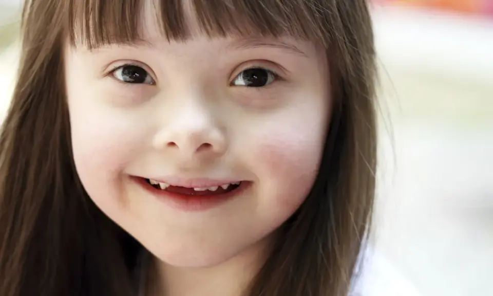 Niña sonriente con síndrome de Down, una condición que no define su luz.