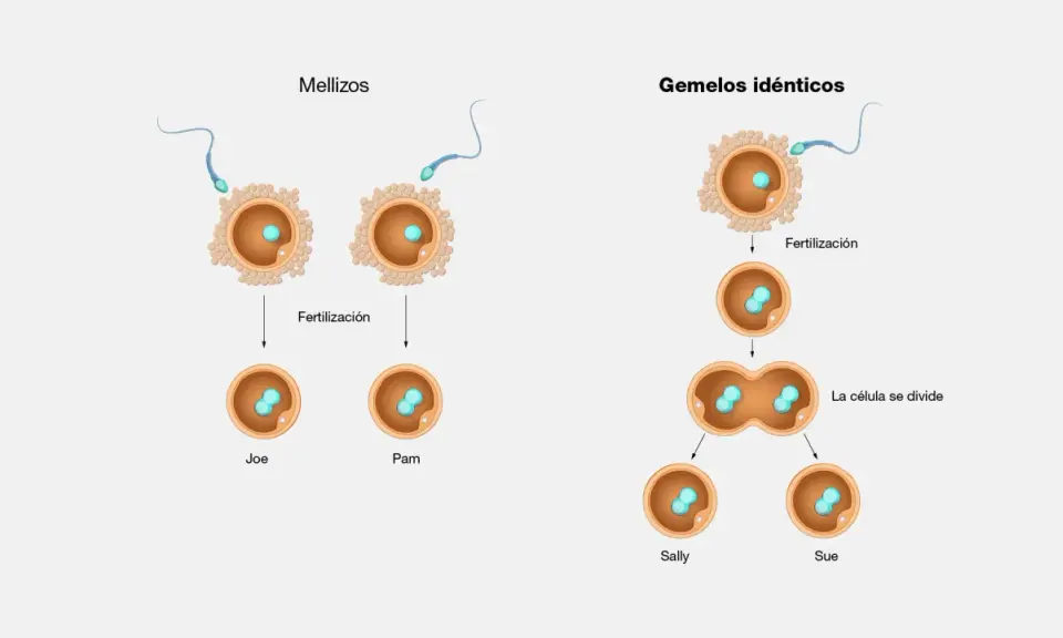 Ilustración de la fertilización de óvulos por espermatozoides, mostrando mellizos y gemelos idénticos.